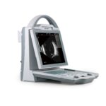 ODU5 Ophthalmic AB Scan